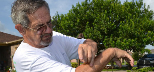 Beekeeper stings arm with bee